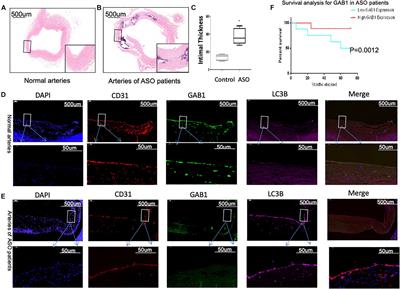 Enhanced Autophagy in GAB1-Deficient Vascular Endothelial Cells Is Responsible for Atherosclerosis Progression